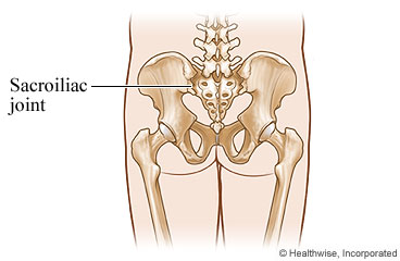 sacroiliac joint pain